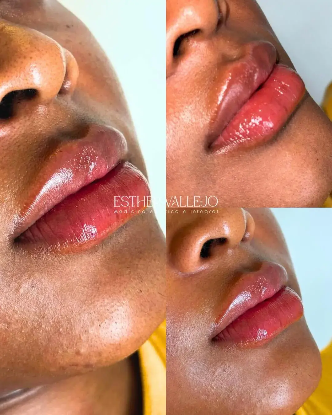 448251584_18407448820076916_23832895035282947_n