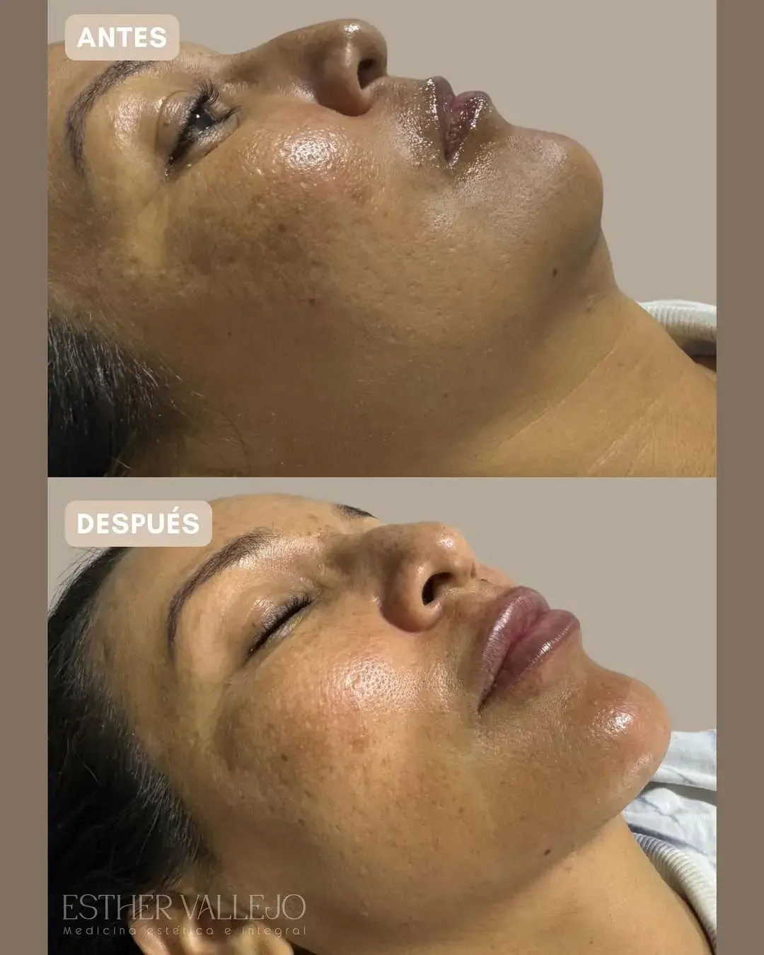 474746653_18447253951076916_987030860865406511_n