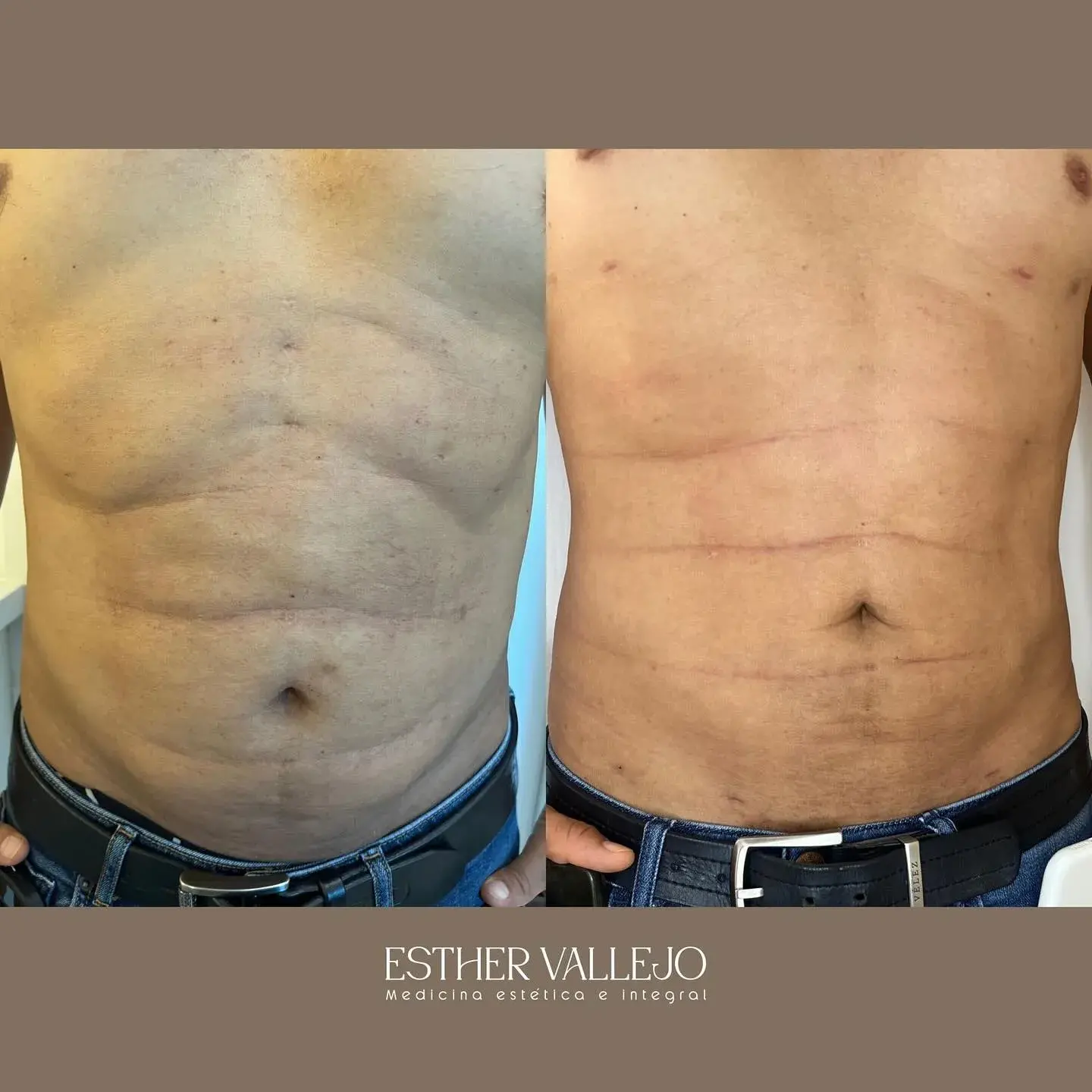 474781440_18447265264076916_7309936774026226673_n