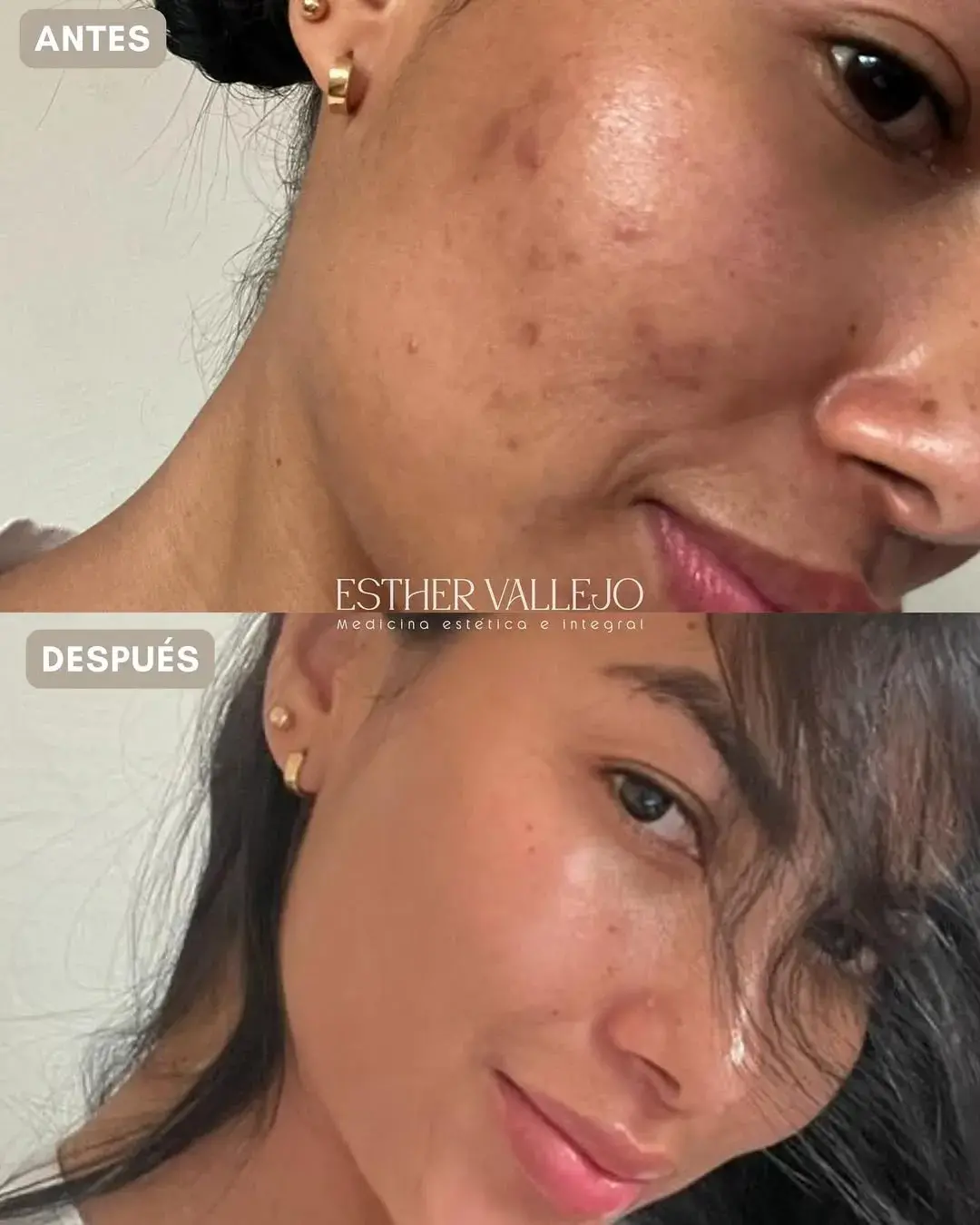 474948109_18447251821076916_4688766120937308031_n